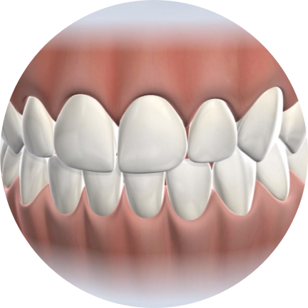 KOMS/DEV/homepage procedure-oral-surgery