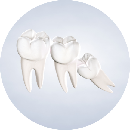 KOMS/DEV/homepage procedure-wisdom-teeth