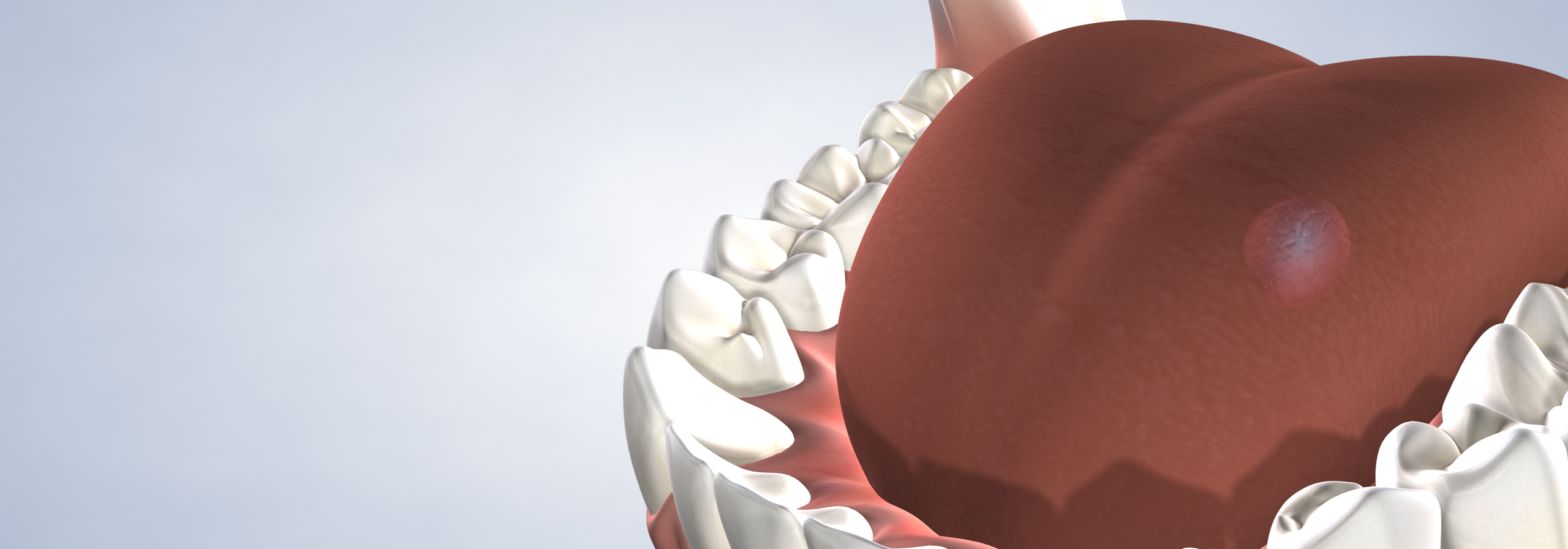 Oral pathology in Louisville and Mt. Washington, KY, and Jeffersonville, IN